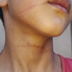 Garoto de 8 anos é atingido por linha com cerol, cai da bicicleta e quase é atropelado em Água Clara (MS)