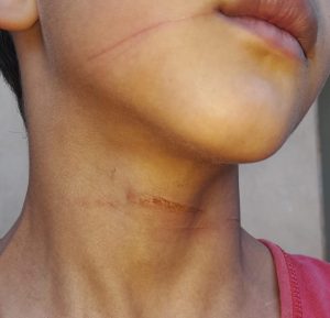 Garoto de 8 anos é atingido por linha com cerol, cai da bicicleta e quase é atropelado em Água Clara (MS) Garoto de 8 anos é atingido por linha com cerol, cai da bicicleta e quase é atropelado em Água Clara (MS)