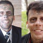 Transformação marcante: homem mais tatuado do Brasil remove tatuagens após se tornar evangélico