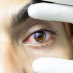ACANTHAMOEBA: RISCOS E PREVENÇÃO EM LENTES DE CONTATO