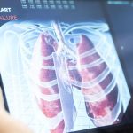 PULMÕES ARTIFICIAIS: MARCO NA MEDICINA MODERNA